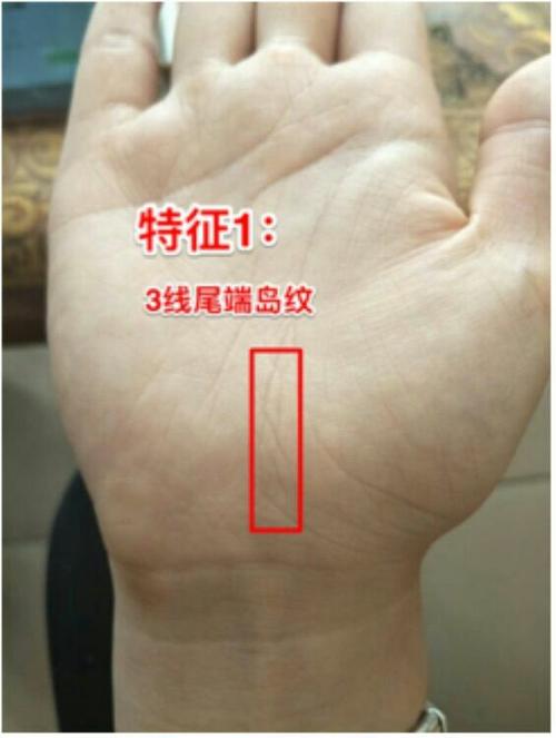 女性右手生命线有岛纹
