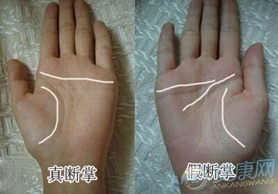 为什么假断掌要比真断掌要好