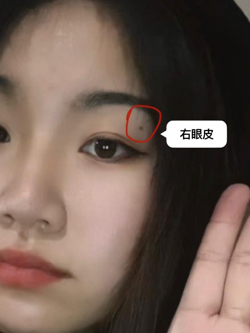 女人右上眼皮有痣好吗