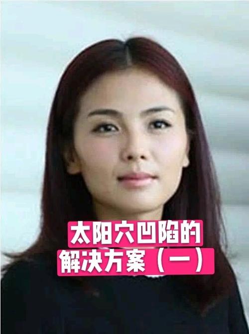 女人太阳凹陷的人命苦吗