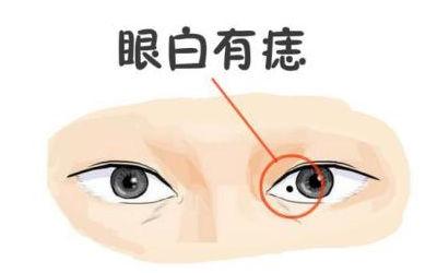 眼白有痣的男人非常好色?