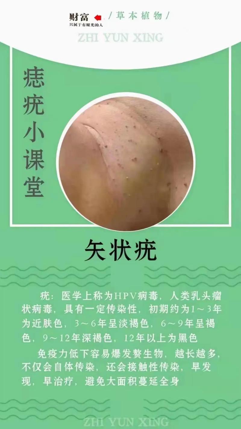 相学看脸上没有痣好吗对运势没影响吗(讲解)