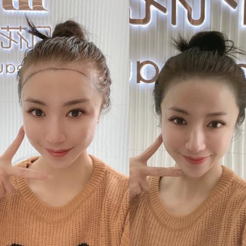 发际线高的女人不能要