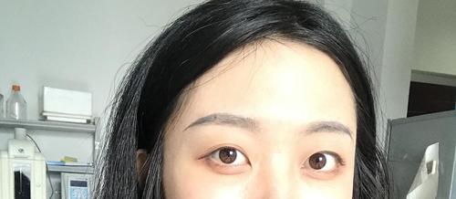 面相一个眼睛大一个眼睛小,是什么原因?