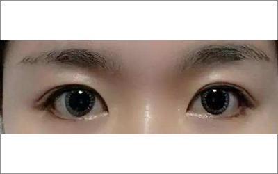 解析圆眼的女人财运状况
