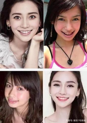整牙对命运的影响