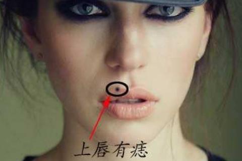嘴唇上的痣是好是坏