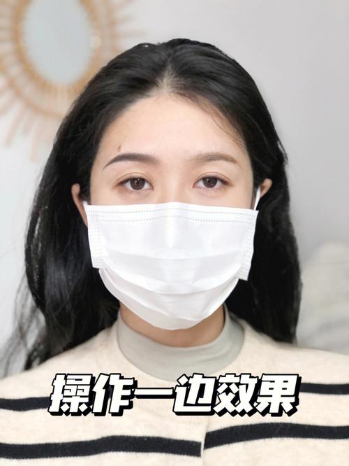 额头窄是什么原因造成的