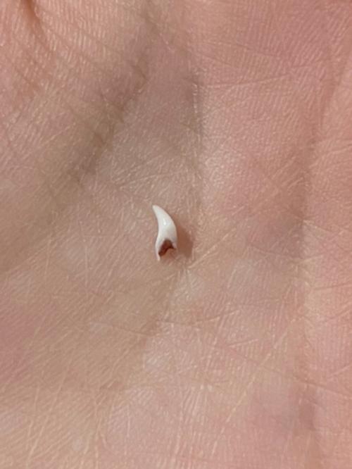 梦见掉了三颗牙没流血预兆什么