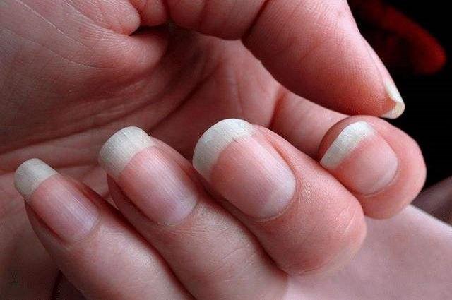 手指月牙明显的女人很容易就会怀孕?
