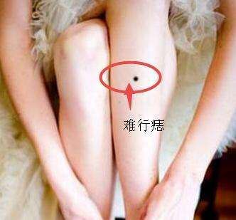 腿上长痣的女人好不好