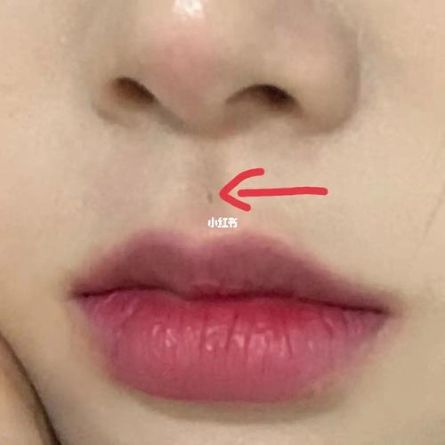 人中凹陷代表什么人中凹陷好吗?