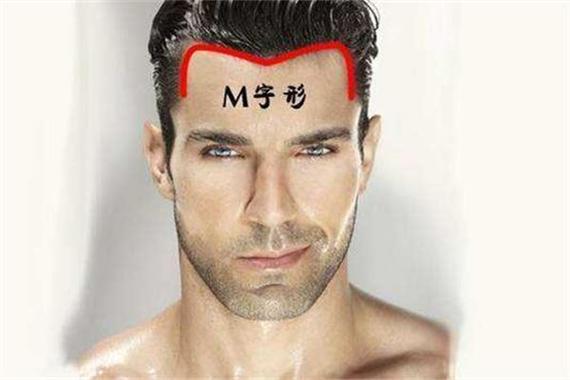 男人m字额代表什么