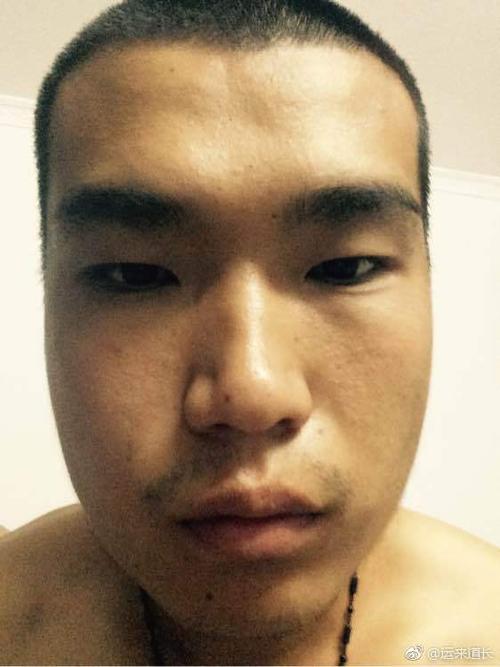 男人额头凹陷面相