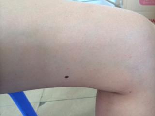 大腿内侧有痣的女人
