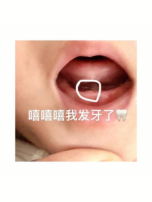 梦见小孩长牙