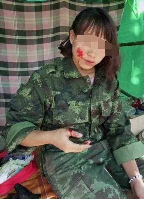 女人梦到自己中了枪伤