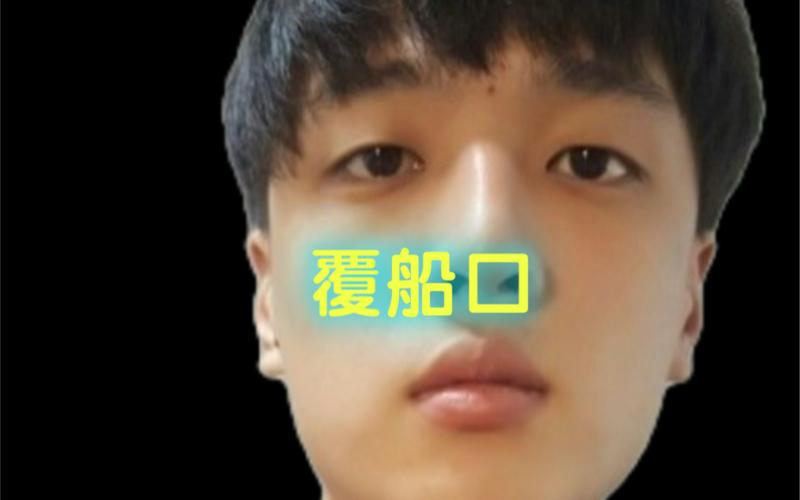 覆船口面相的人一定不好吗