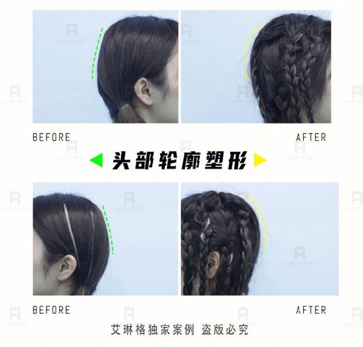 为什么老一辈喜欢平后脑勺