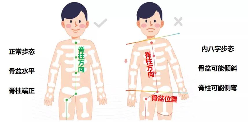 肢体伤残的八字特征