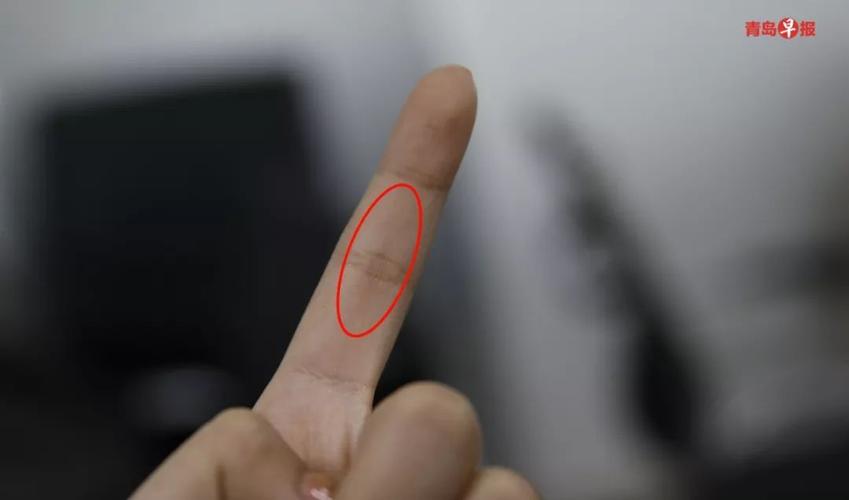 梦见手露青筋好不好