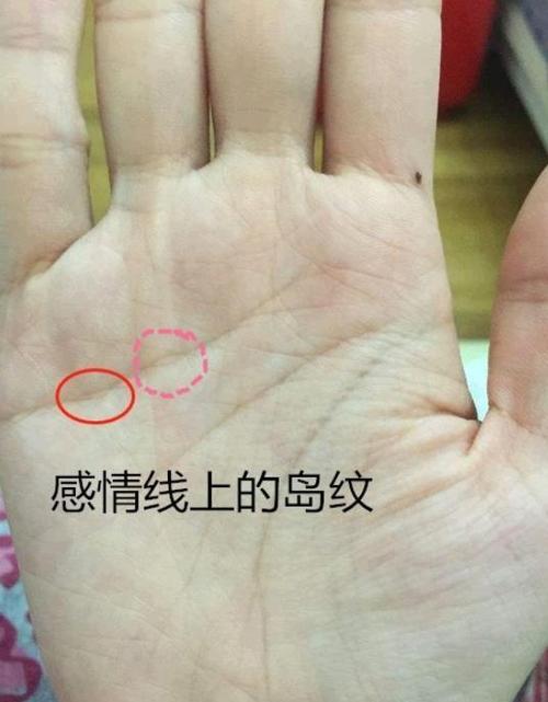 岛纹是什么 岛纹 手相