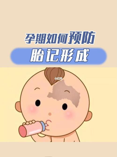 胎记形成的原因是什么?