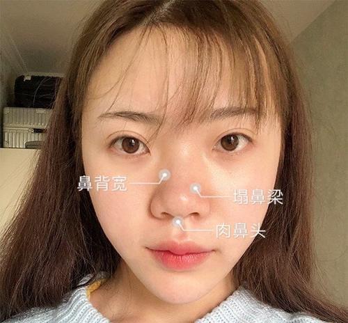 蒜头鼻的女人难嫁？