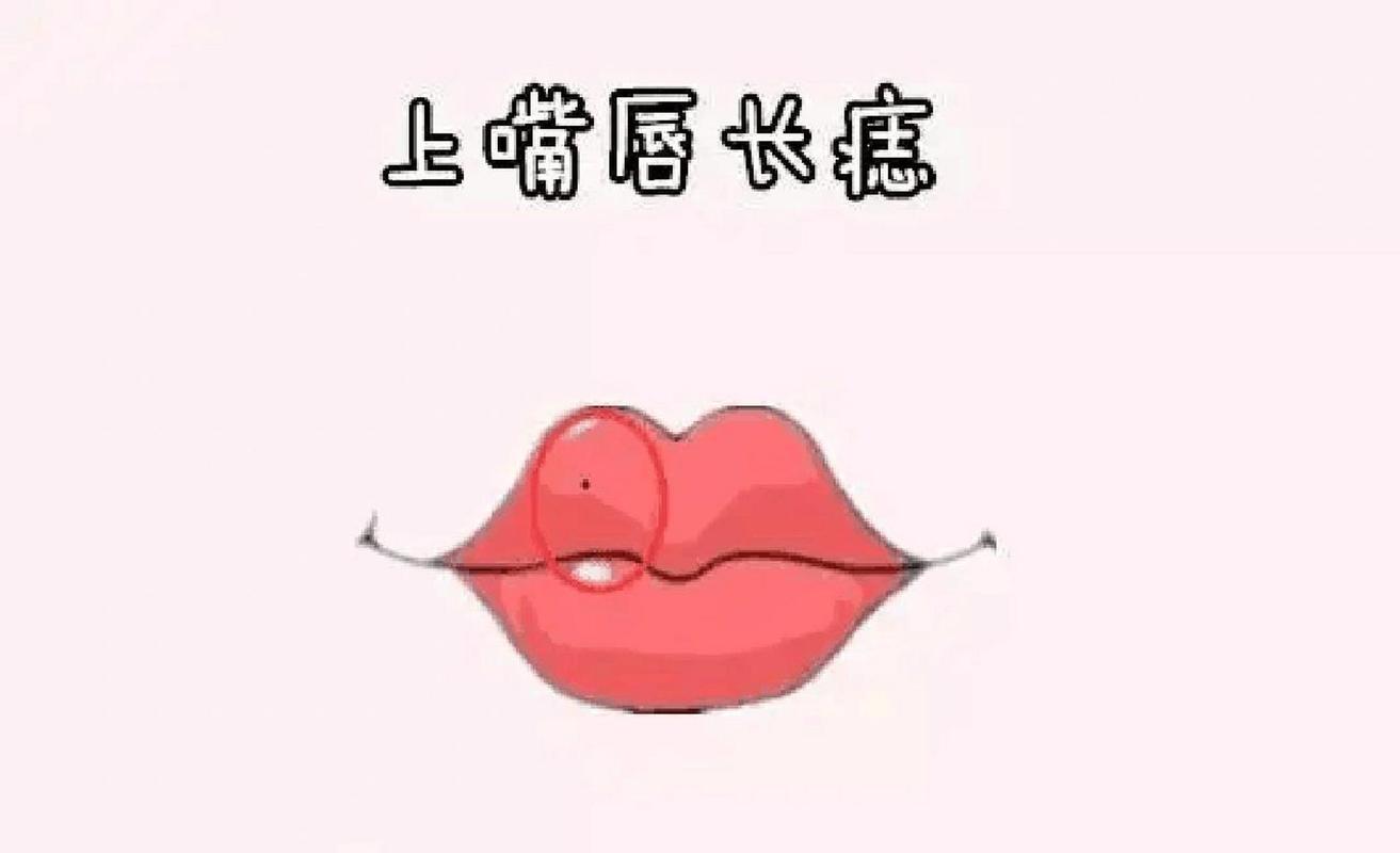 女人嘴周围长痣好吗