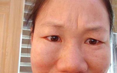 悬针纹女人克子吗