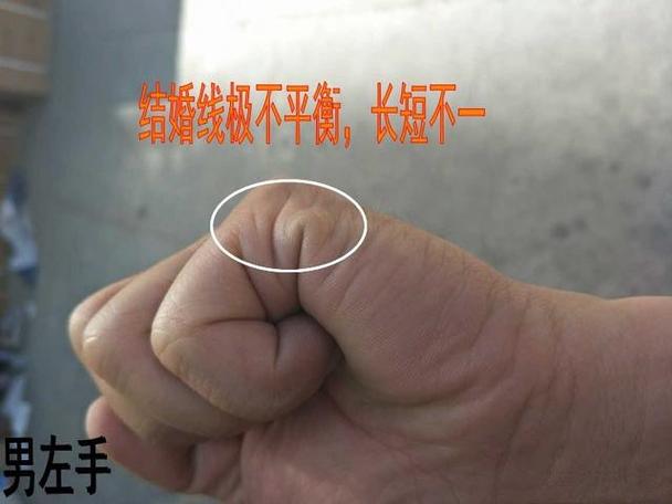姻缘线两条一长一短