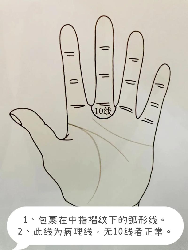 独朝纹手相解析