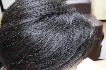 中年女人梦见长白头发
