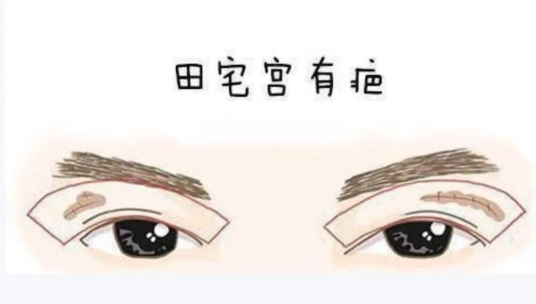 命太好的人眼睛要留疤,眼尾有疤的人命好吗