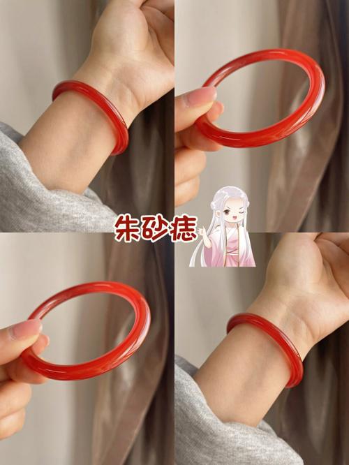 朱砂痣能点掉吗