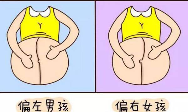 妊娠线看男女准吗