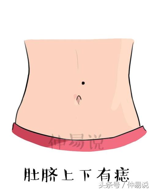 肚脐眼外侧有痣寓意衣食无忧是真的吗?