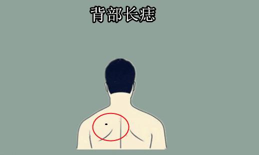 后背有三颗痣成三角形