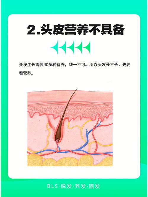 头发掉不停 跟家中环境是否有关系?