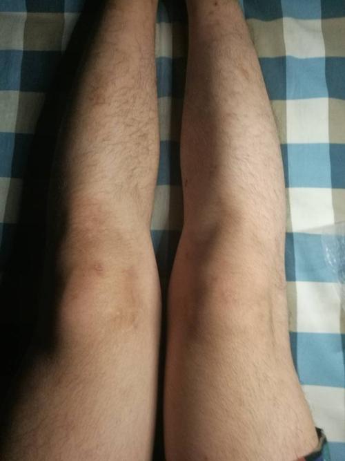 男人罗圈腿命好不好