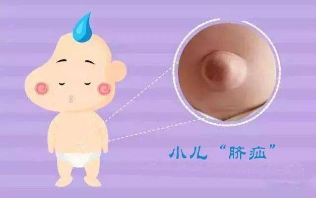 梦见脐带怎么回事