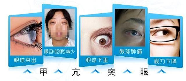 金鱼眼之人喜欢武力发泄不满