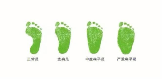梦见脚跟好吗,梦见脚印代表了什么?