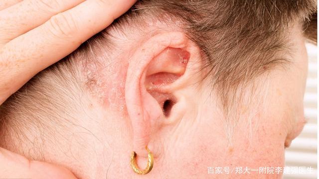 左耳朵痒是偏财运