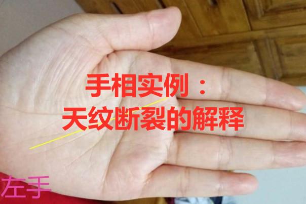 通天纹中间有断是什么事