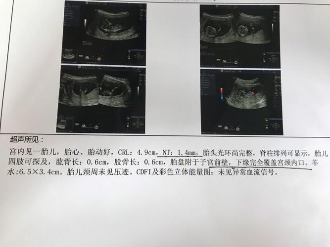 神奇的胎梦,真是胎儿“传递”的信号?实际上,它有着更大的作用