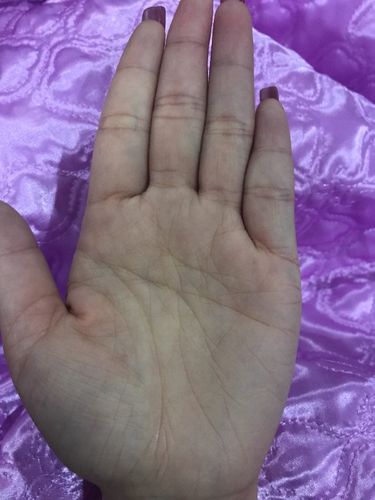 假断掌的女人