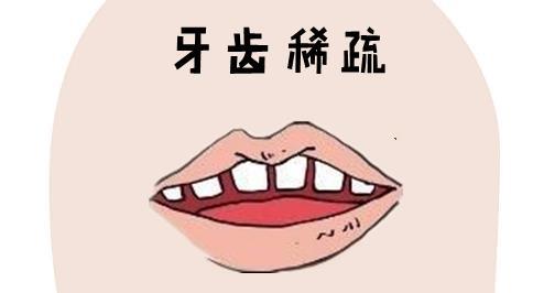 牙齿稀疏的人是不是更喜欢撒谎