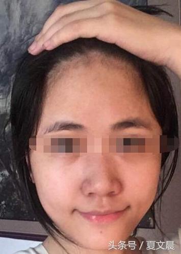 女人额头窄脸大面相是穷命吗