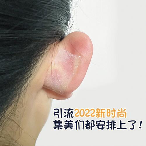 怎么变成招风耳